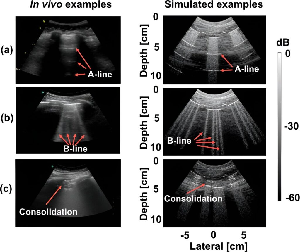 AI can now detect COVID-19 in lung ultrasound images.